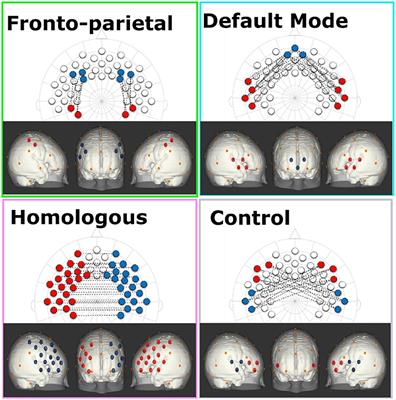 Variability in Infants' Functional Brain Network Connectivity Is Associated With Differences in Affect and Behavior